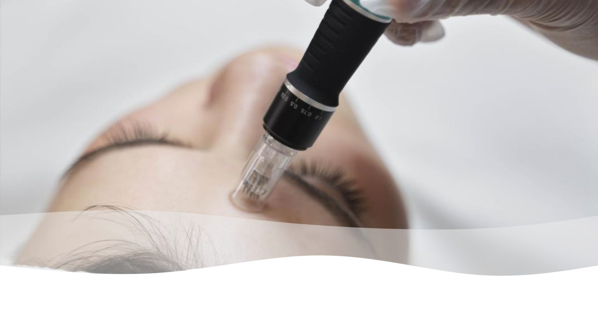 مزونیدلینگ