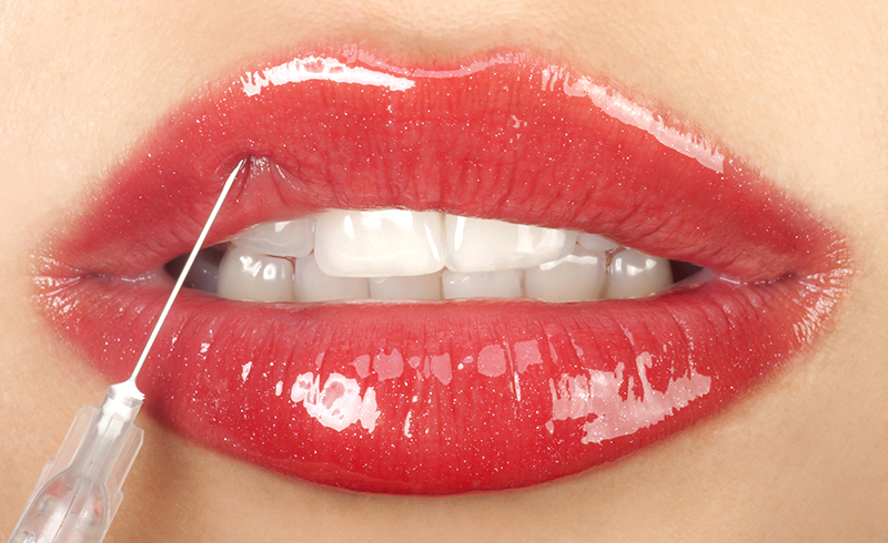 تاثیر ژل لب روسی بر چهره