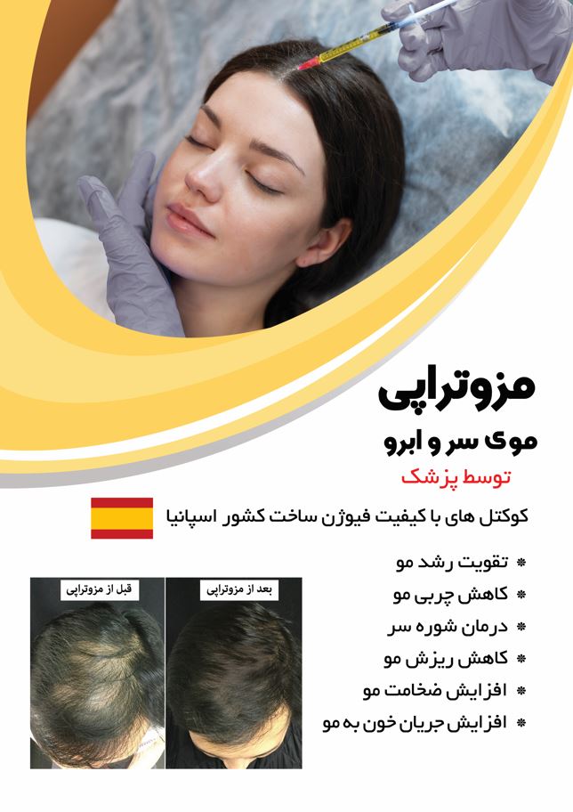مزوتراپی موی سر