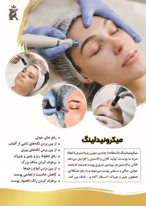 میکرونیدلینگ