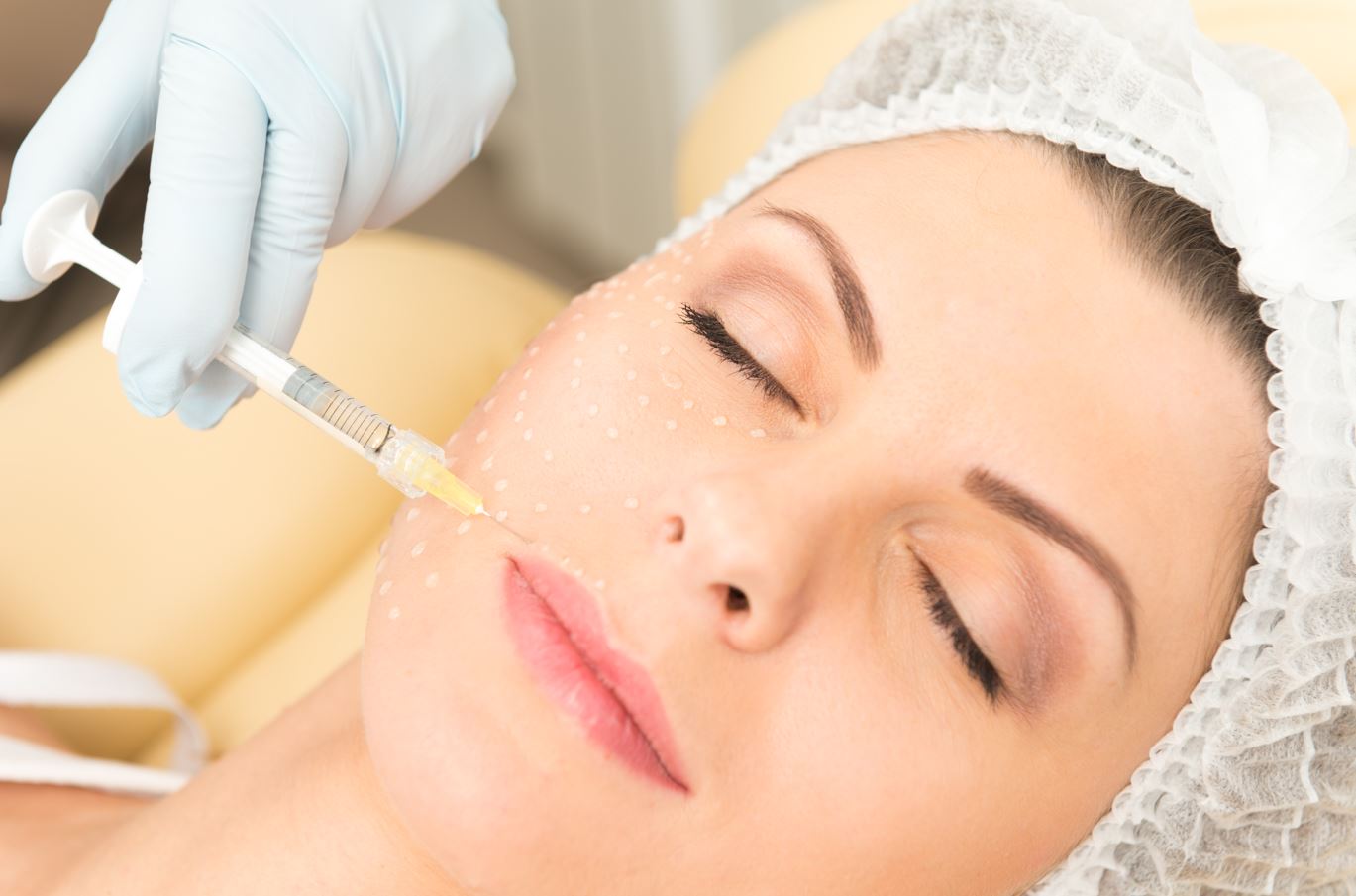 مزوتراپی صورت